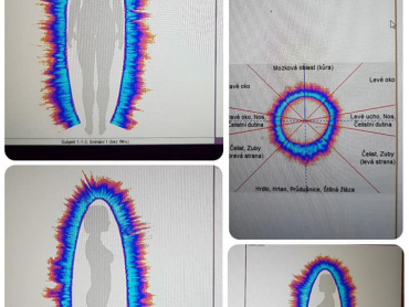 1. rexlexologie a různé pohledy