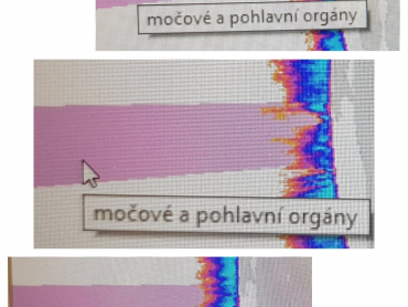 1. výseče ke konkrétné zóně Aureoly