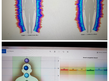 2. pěkné biopole i čakry v harmonii