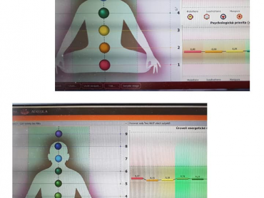 1. 7mi a 9ti čakorové zobrazení