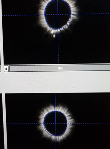 2. detail zachycuje různé obrysy enetgeického pole